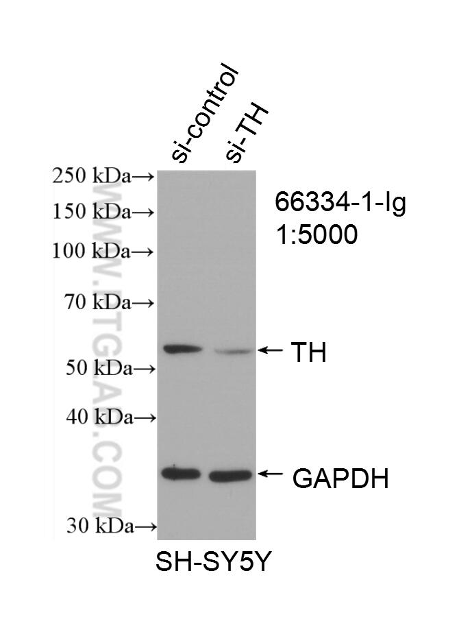 Western Blot (WB) analysis of SH-SY5Y cells using TH Monoclonal antibody (66334-1-Ig)