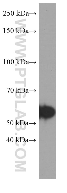 WB analysis of SH-SY5Y using 66334-1-Ig