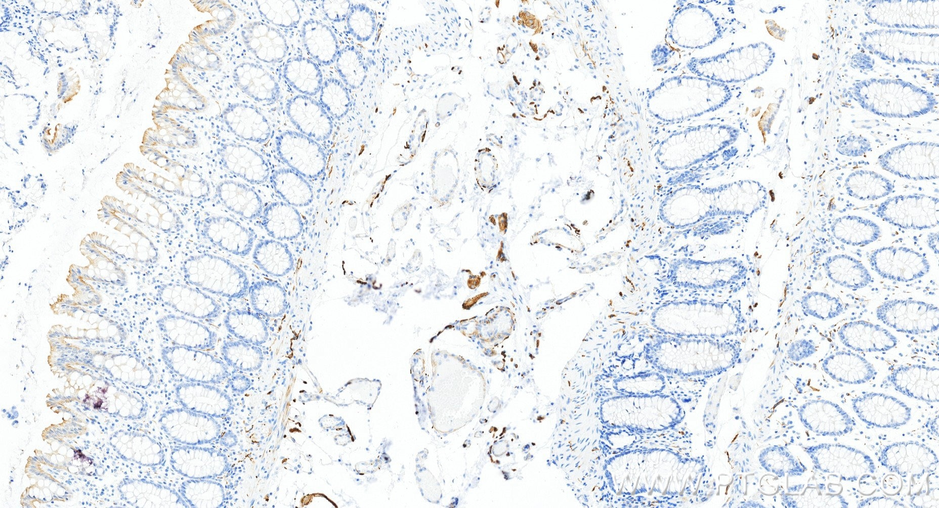 Immunohistochemistry (IHC) staining of human colon tissue using TH Recombinant monoclonal antibody (85929-5-RR)