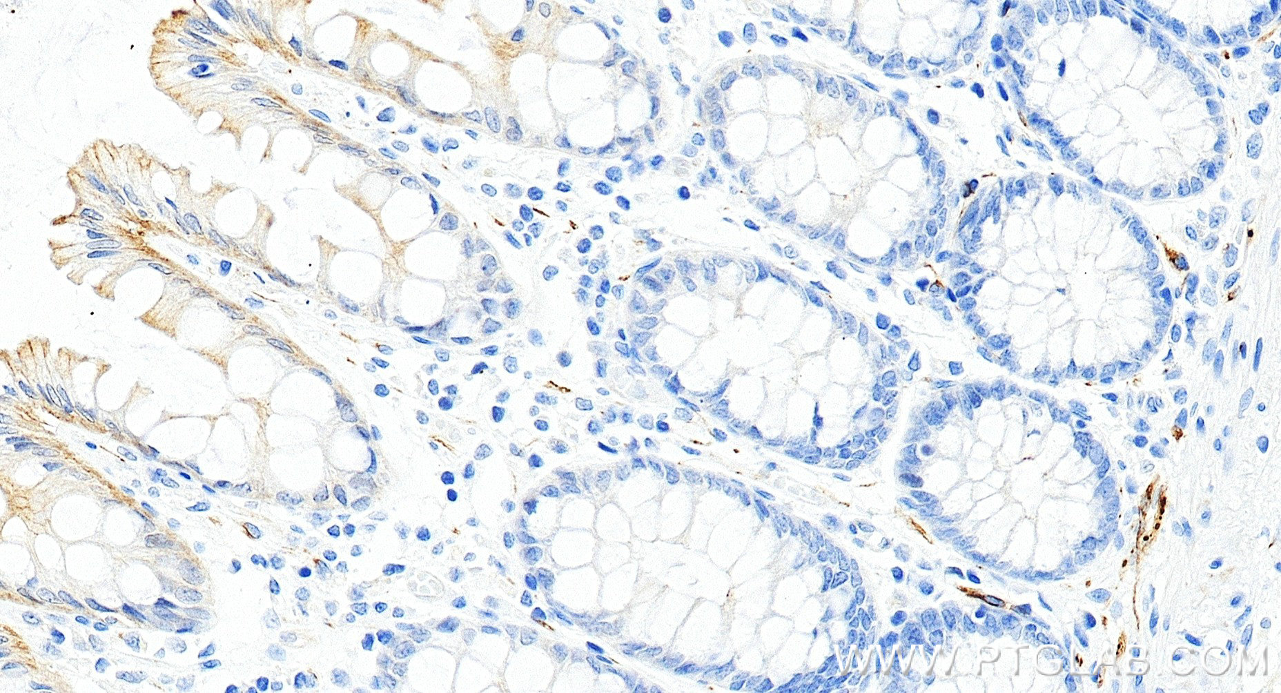 Immunohistochemistry (IHC) staining of human colon tissue using TH Recombinant monoclonal antibody (85929-5-RR)