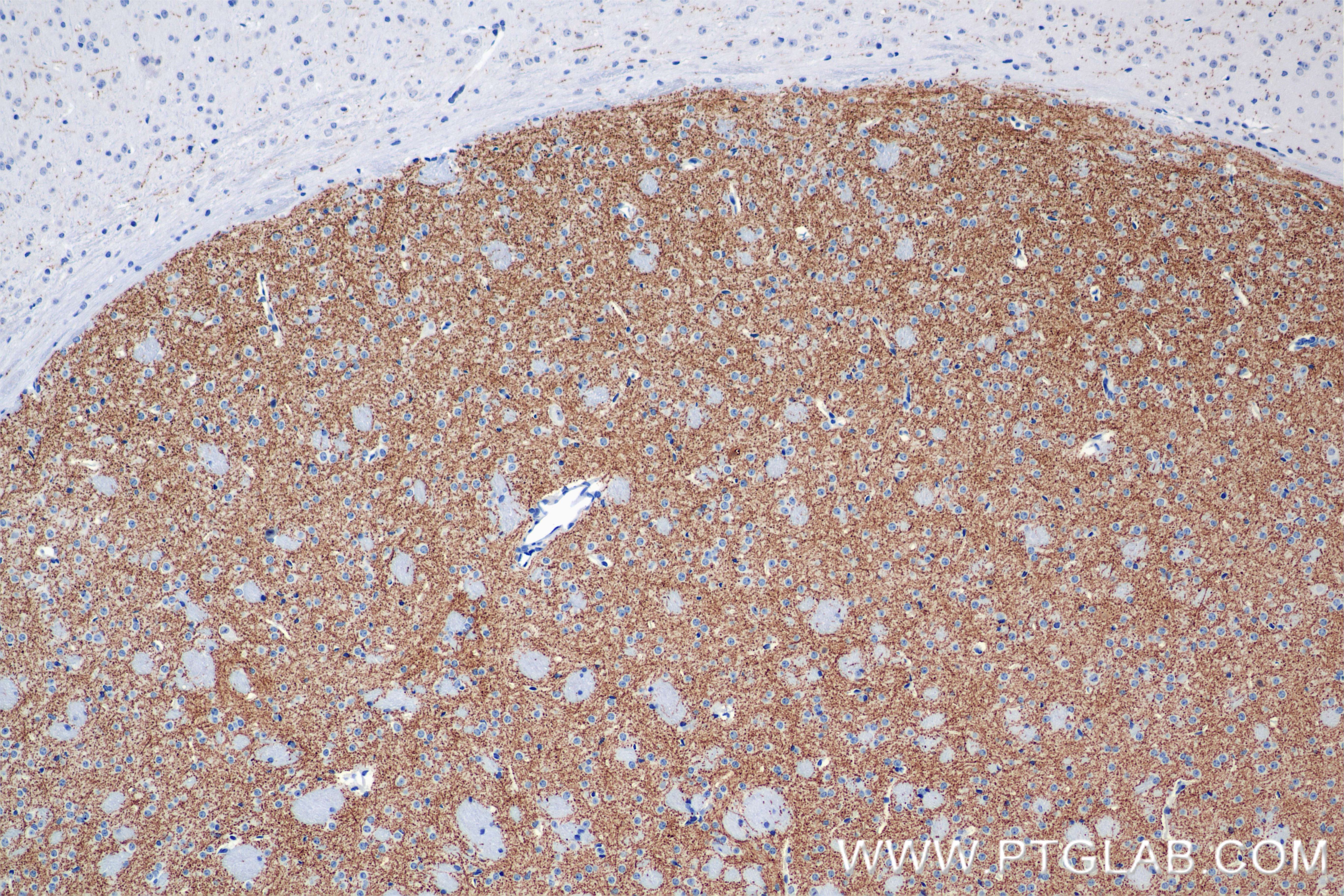 Immunohistochemistry (IHC) staining of mouse brain tissue using TH Recombinant monoclonal antibody (85929-5-RR)