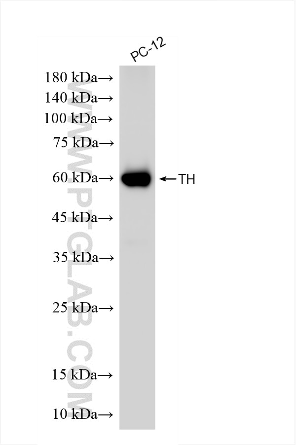 Western Blot (WB) analysis of PC-12 cells using TH Recombinant antibody (85929-5-RR)