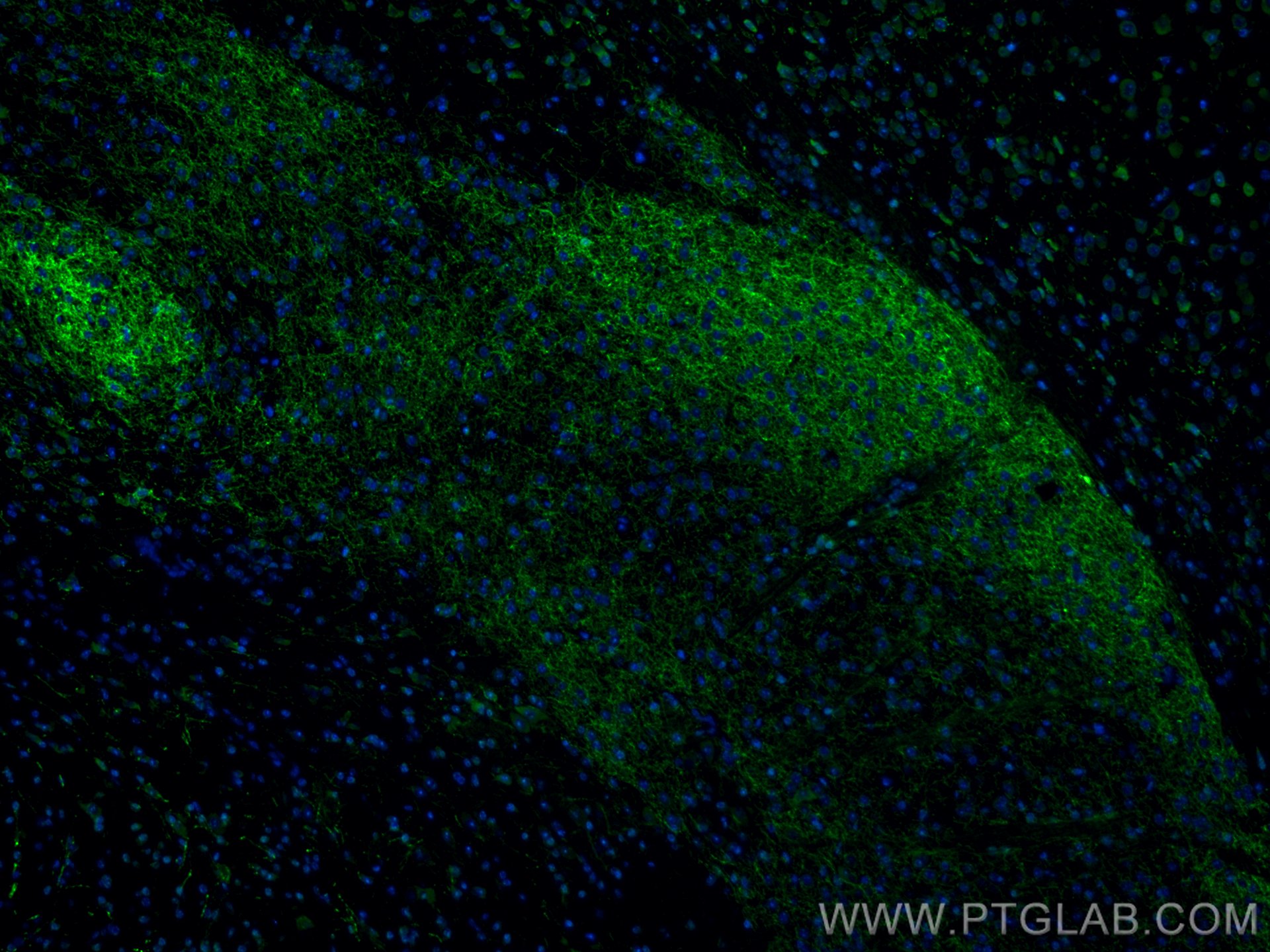 IF Staining of mouse brain using CL488-25859