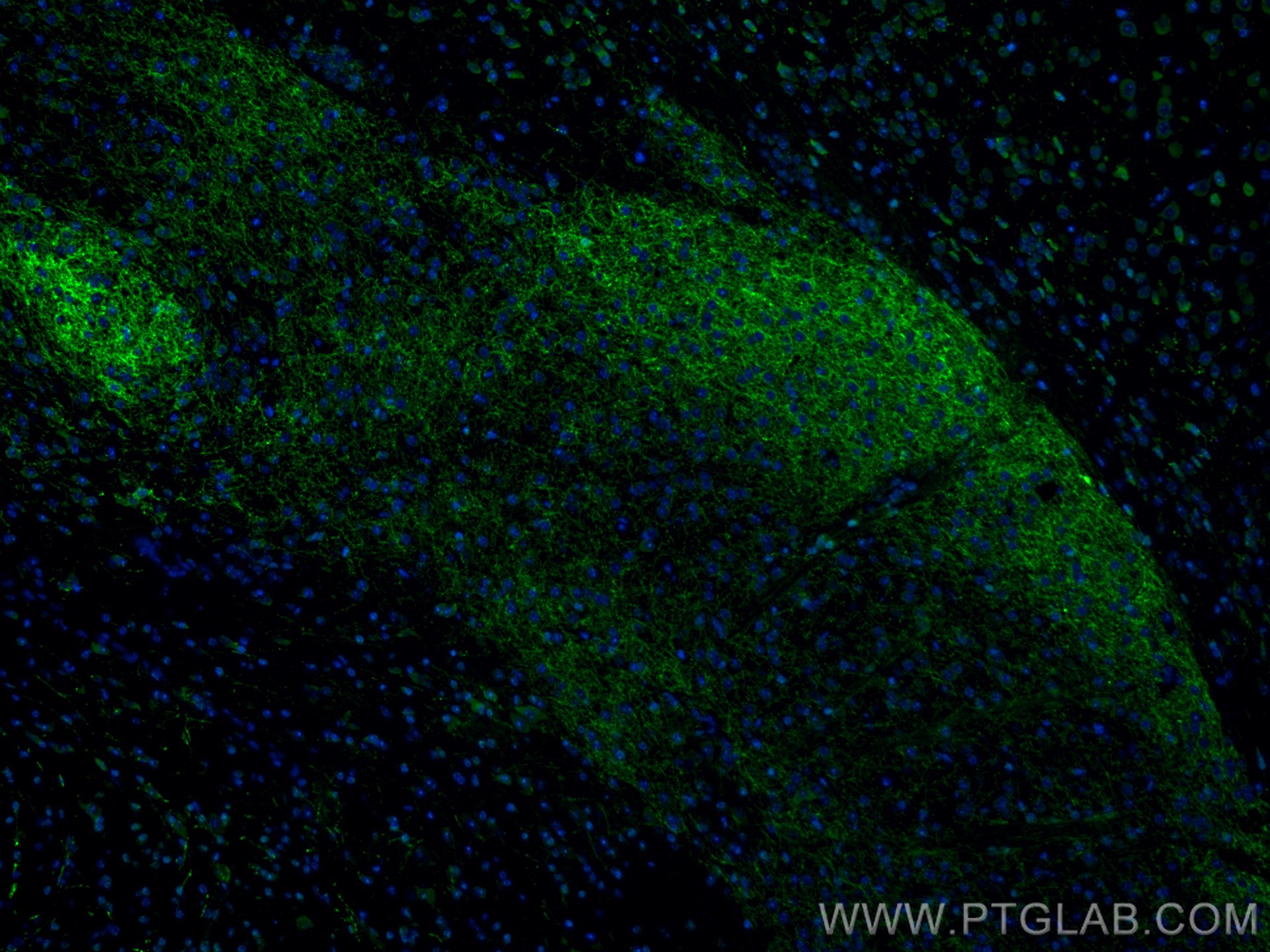 Immunofluorescence (IF) / fluorescent staining of mouse brain tissue using CoraLite® Plus 488-conjugated TH Polyclonal antibo (CL488-25859)