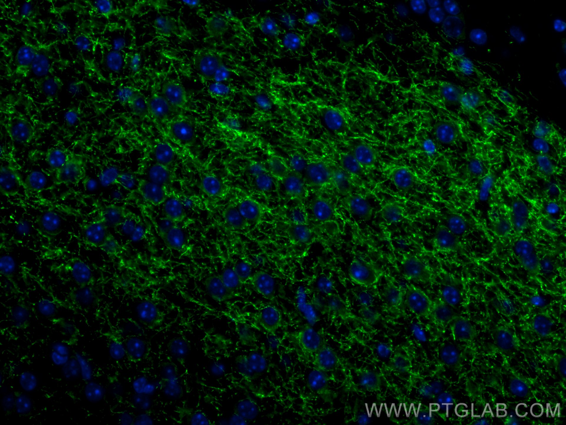 Immunofluorescence (IF) / fluorescent staining of mouse brain tissue using CoraLite® Plus 488-conjugated TH Polyclonal antibo (CL488-25859)