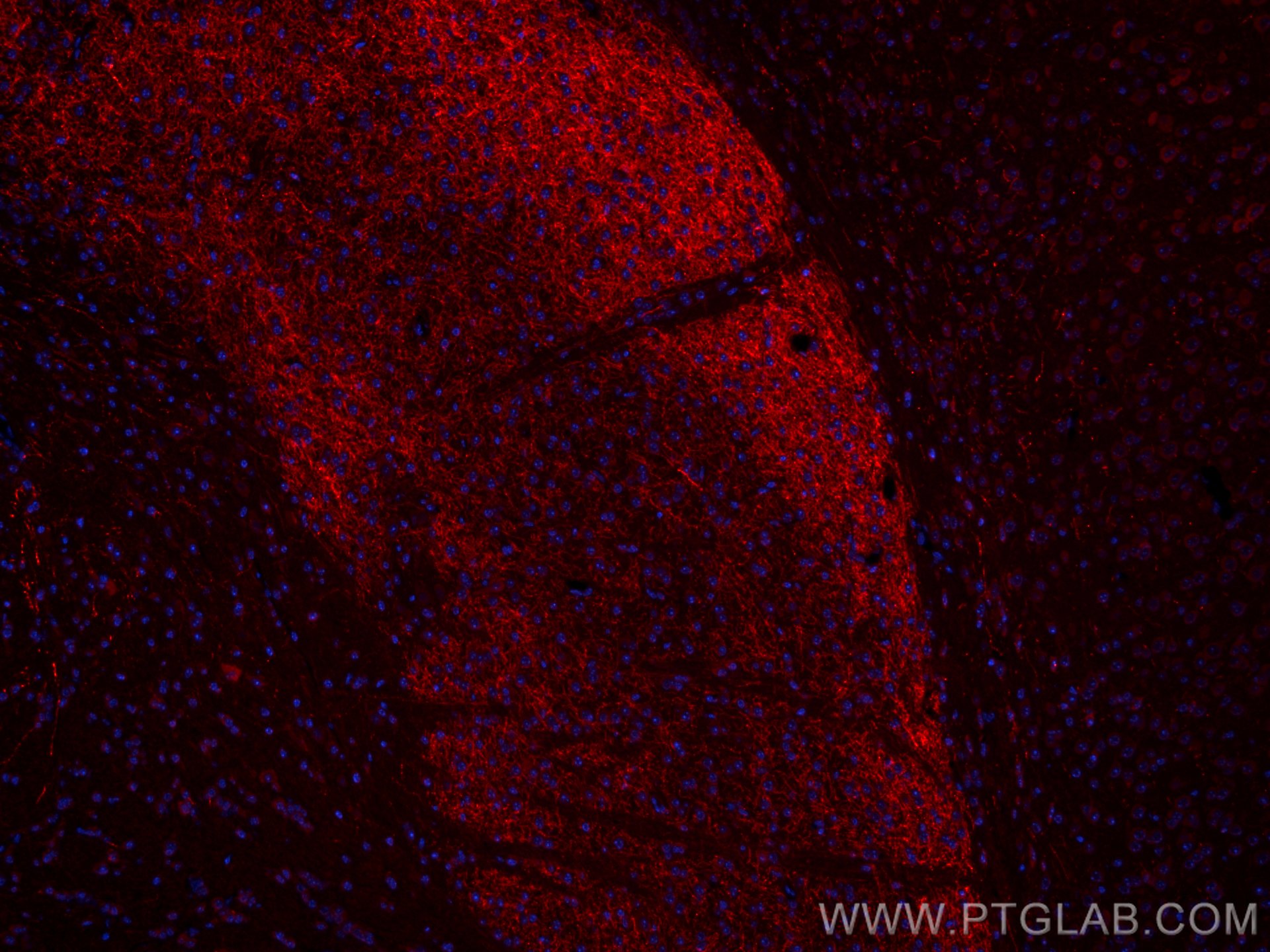 Immunofluorescence (IF) / fluorescent staining of mouse brain tissue using CoraLite®594-conjugated TH Polyclonal antibody (CL594-25859)