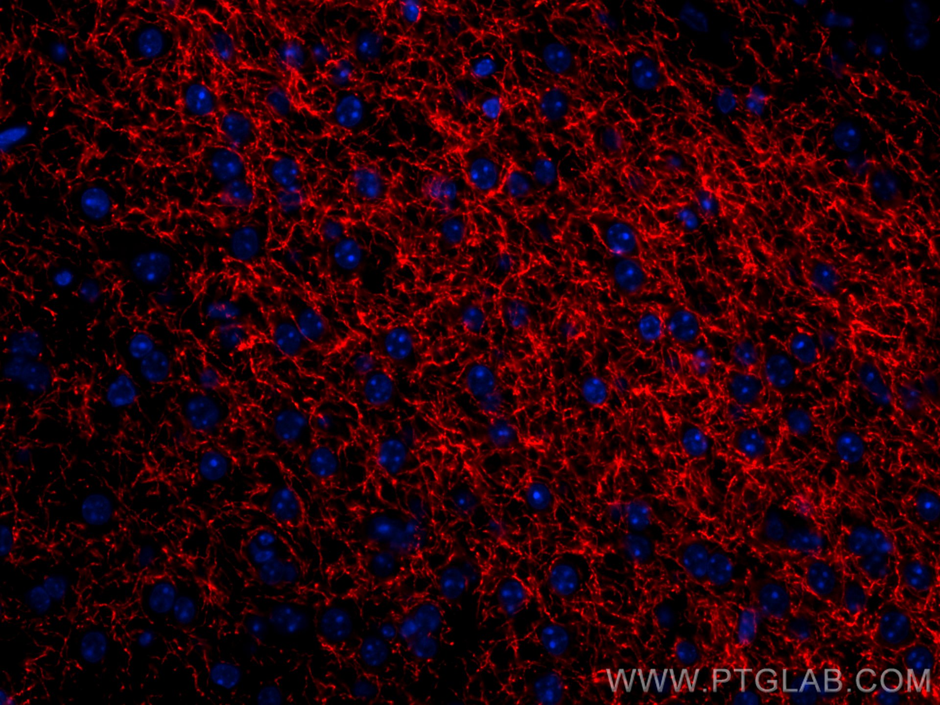 Immunofluorescence (IF) / fluorescent staining of mouse brain tissue using CoraLite®594-conjugated TH Polyclonal antibody (CL594-25859)