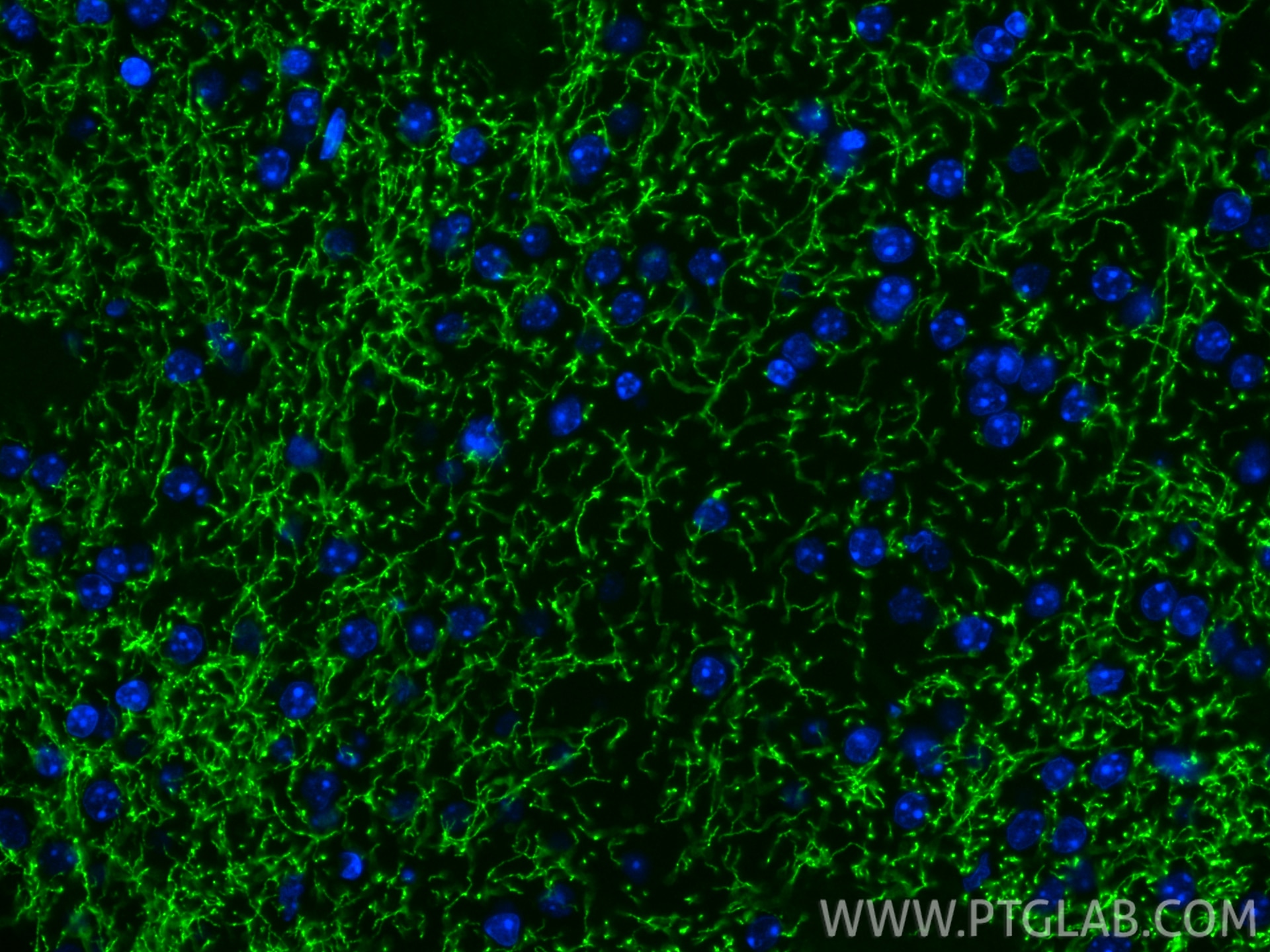 IF Staining of mouse brain using RMX00053 Immunofluorescence (IF) / fluorescent staining of mouse brain tissue using Multi-rAb® TH Multi-Recombinant antibody (RMX00053)