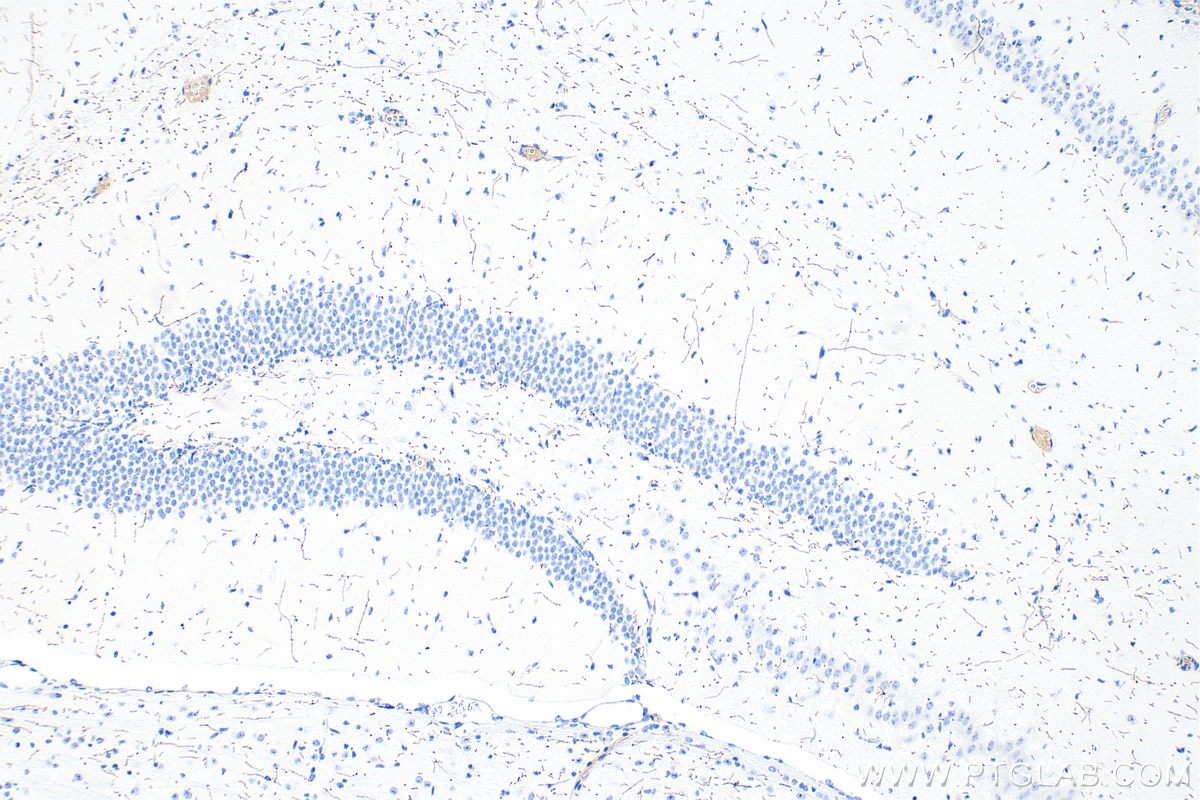 IHC staining of mouse brain using RMX00053 Immunohistochemistry (IHC) staining of mouse brain tissue using Multi-rAb® TH Multi-Recombinant antibody (RMX00053)