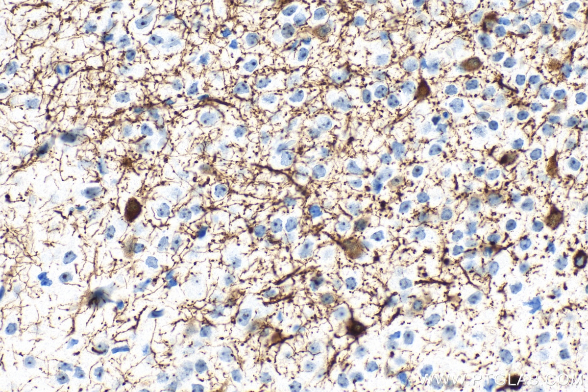 IHC staining of mouse brain using RMX00053 Immunohistochemistry (IHC) staining of mouse brain tissue using Multi-rAb® TH Multi-Recombinant antibody (RMX00053)