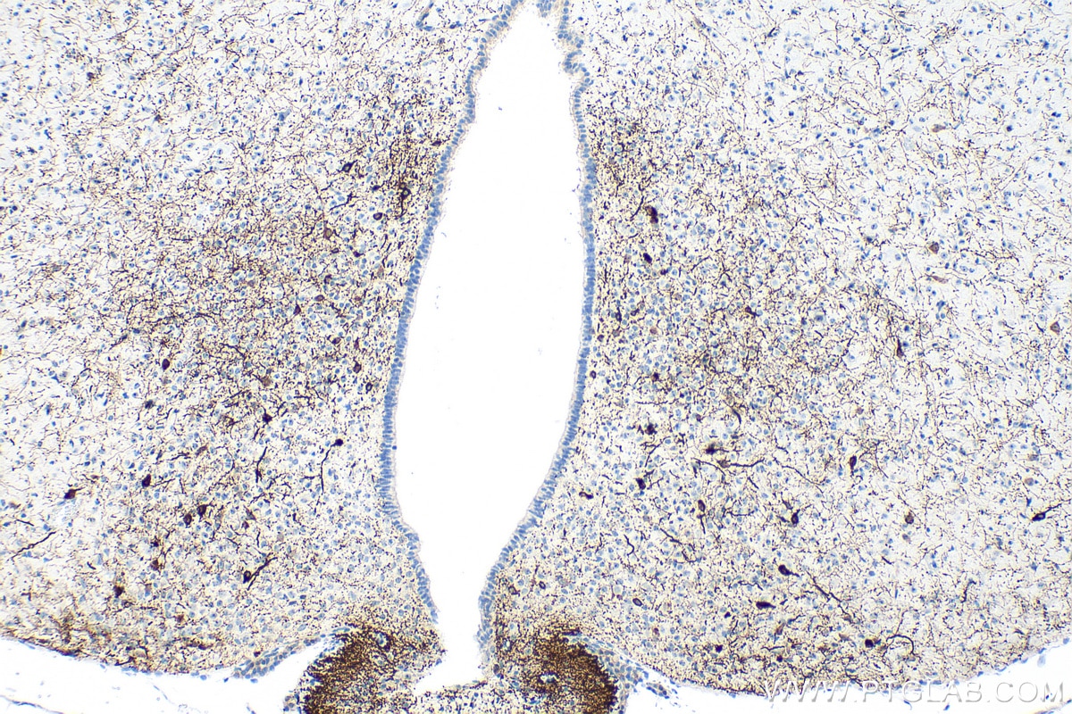 IHC staining of mouse brain using RMX00053 Immunohistochemistry (IHC) staining of mouse brain tissue using Multi-rAb® TH Multi-Recombinant antibody (RMX00053)