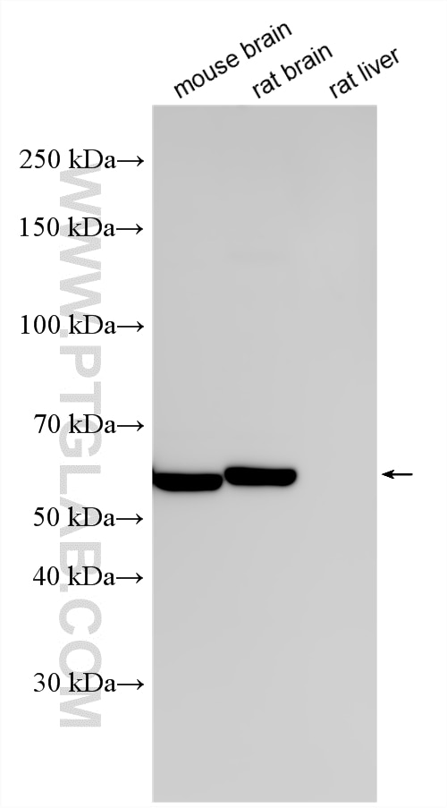 WB analysis using RMX00053 Western Blot (WB) analysis of various lysates using Multi-rAb® TH Multi-Recombinant antibody (RMX00053)