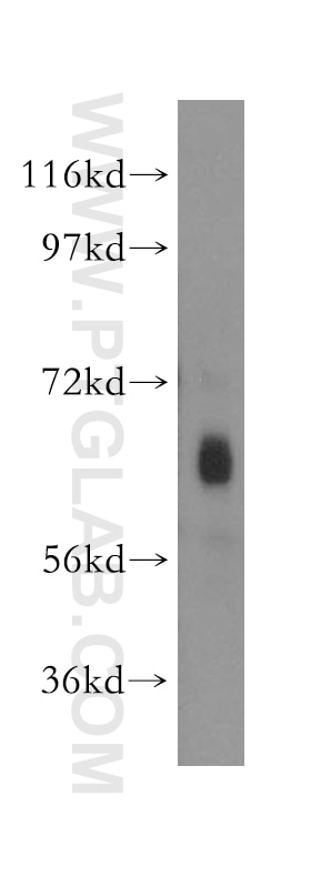 Western Blot (WB) analysis of A549 cells using TH1L Polyclonal antibody (11226-1-AP)