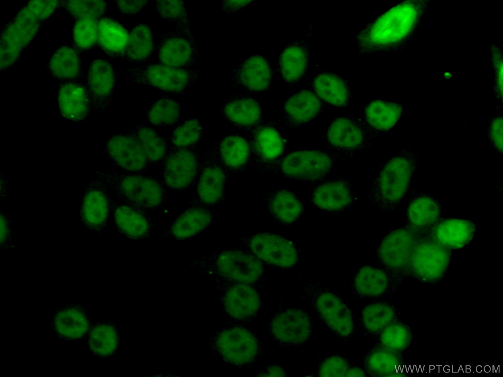 IF Staining of HeLa using 28417-1-AP