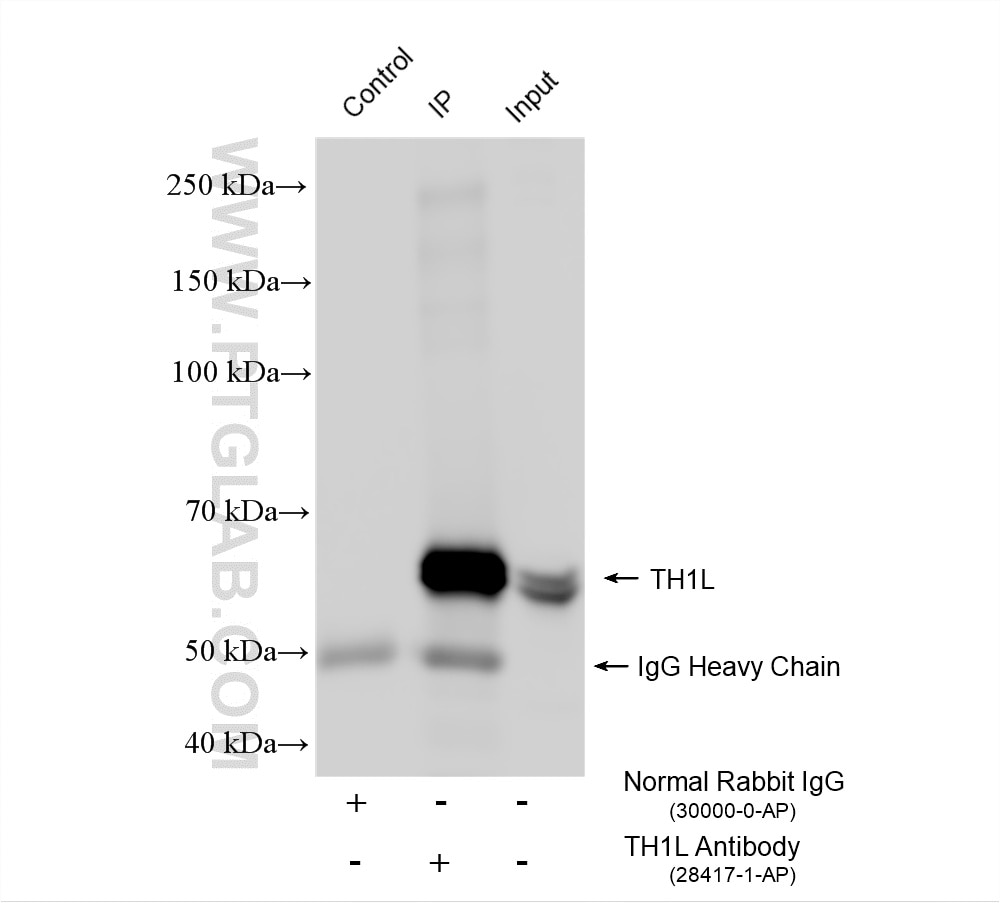 Immunoprecipitation (IP) experiment of Jurkat cells using TH1L Polyclonal antibody (28417-1-AP)
