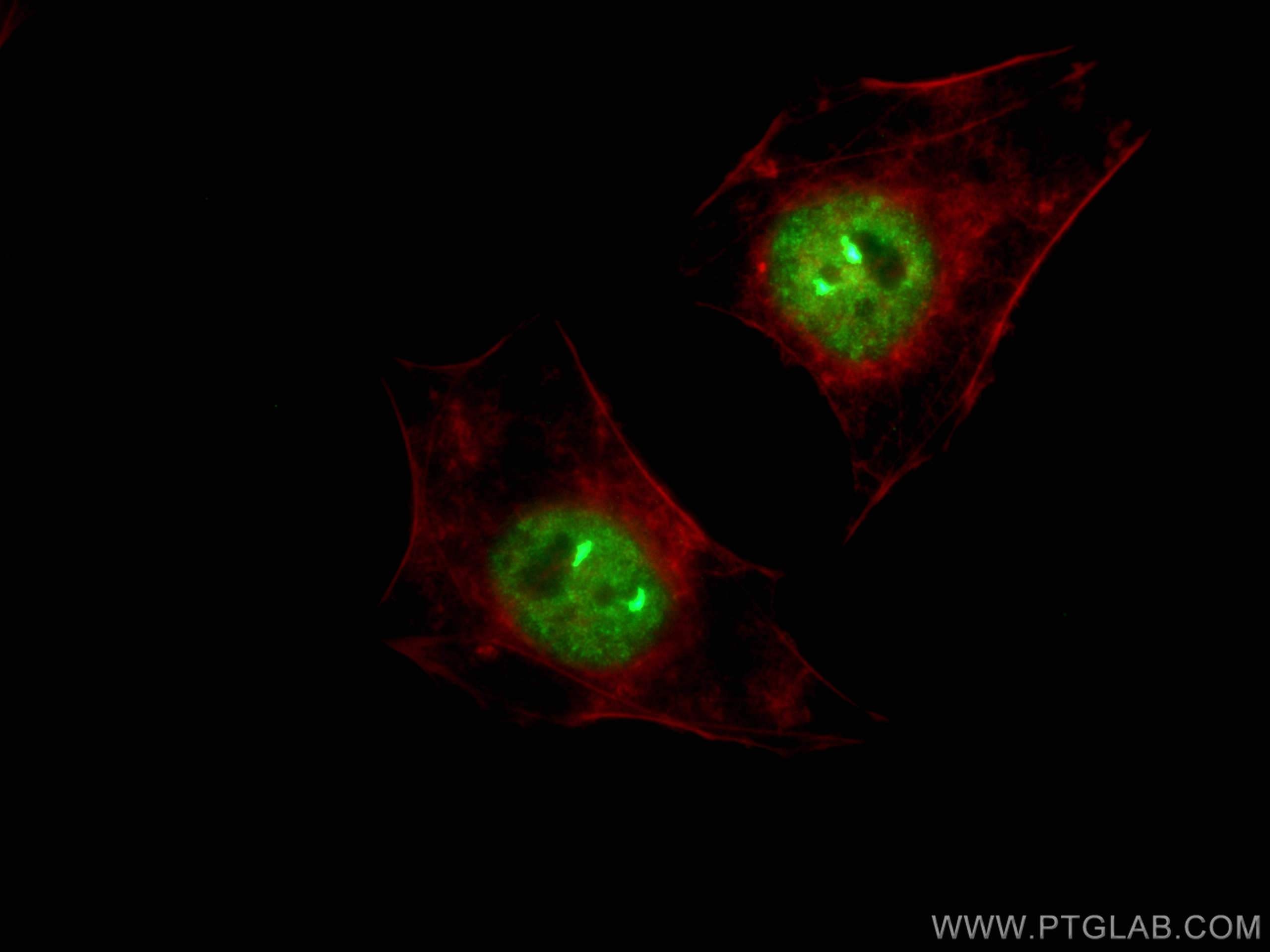 Immunofluorescence (IF) / fluorescent staining of HeLa cells using TH1L Monoclonal antibody (67380-1-Ig)