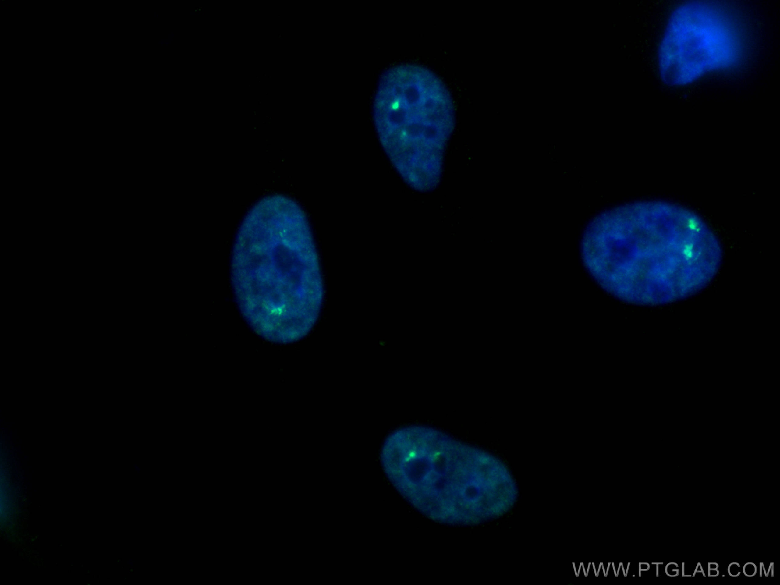 Immunofluorescence (IF) / fluorescent staining of HeLa cells using TH1L Monoclonal antibody (67380-1-Ig)