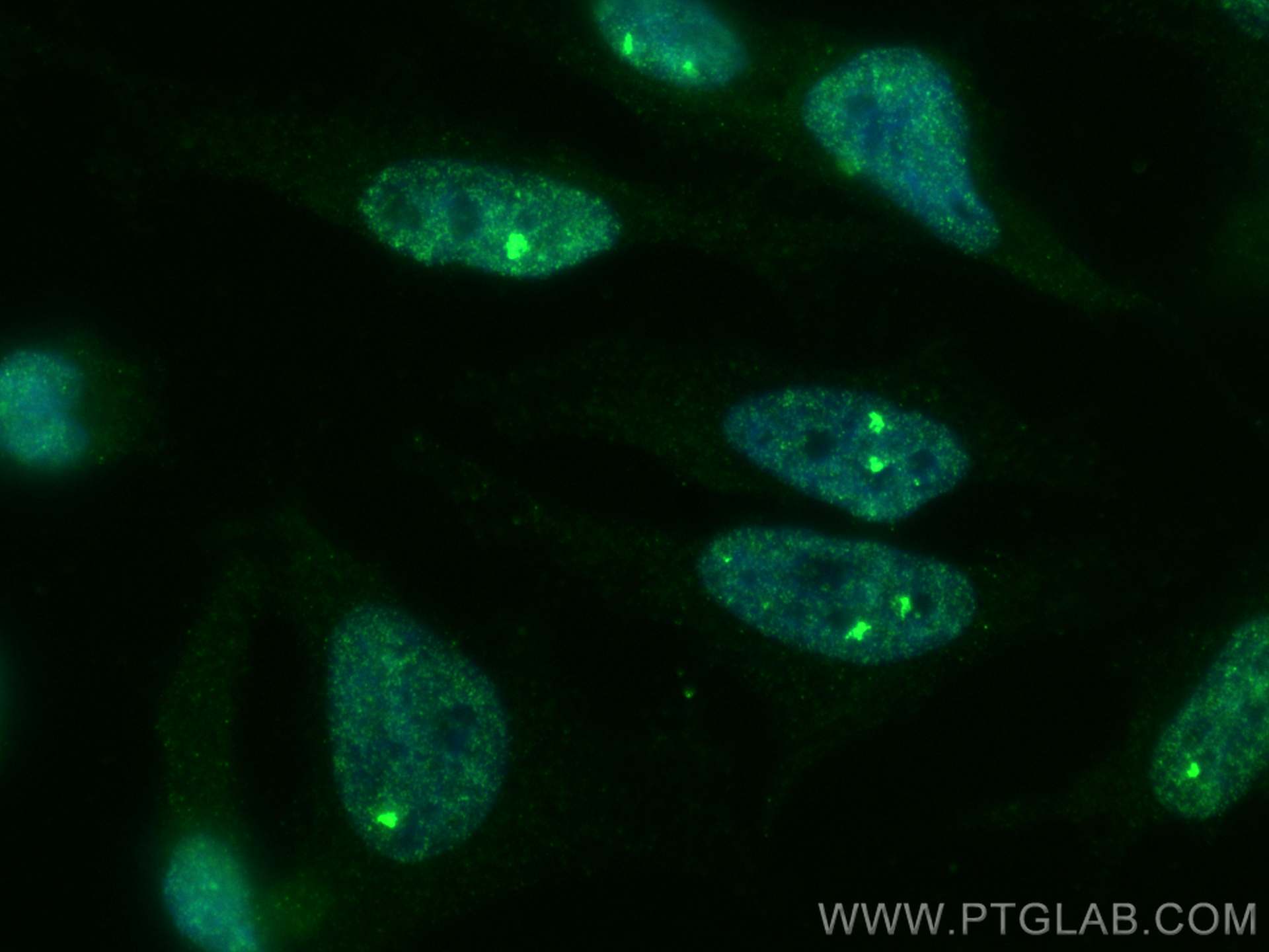 Immunofluorescence (IF) / fluorescent staining of HeLa cells using TH1L Monoclonal antibody (67380-1-Ig)