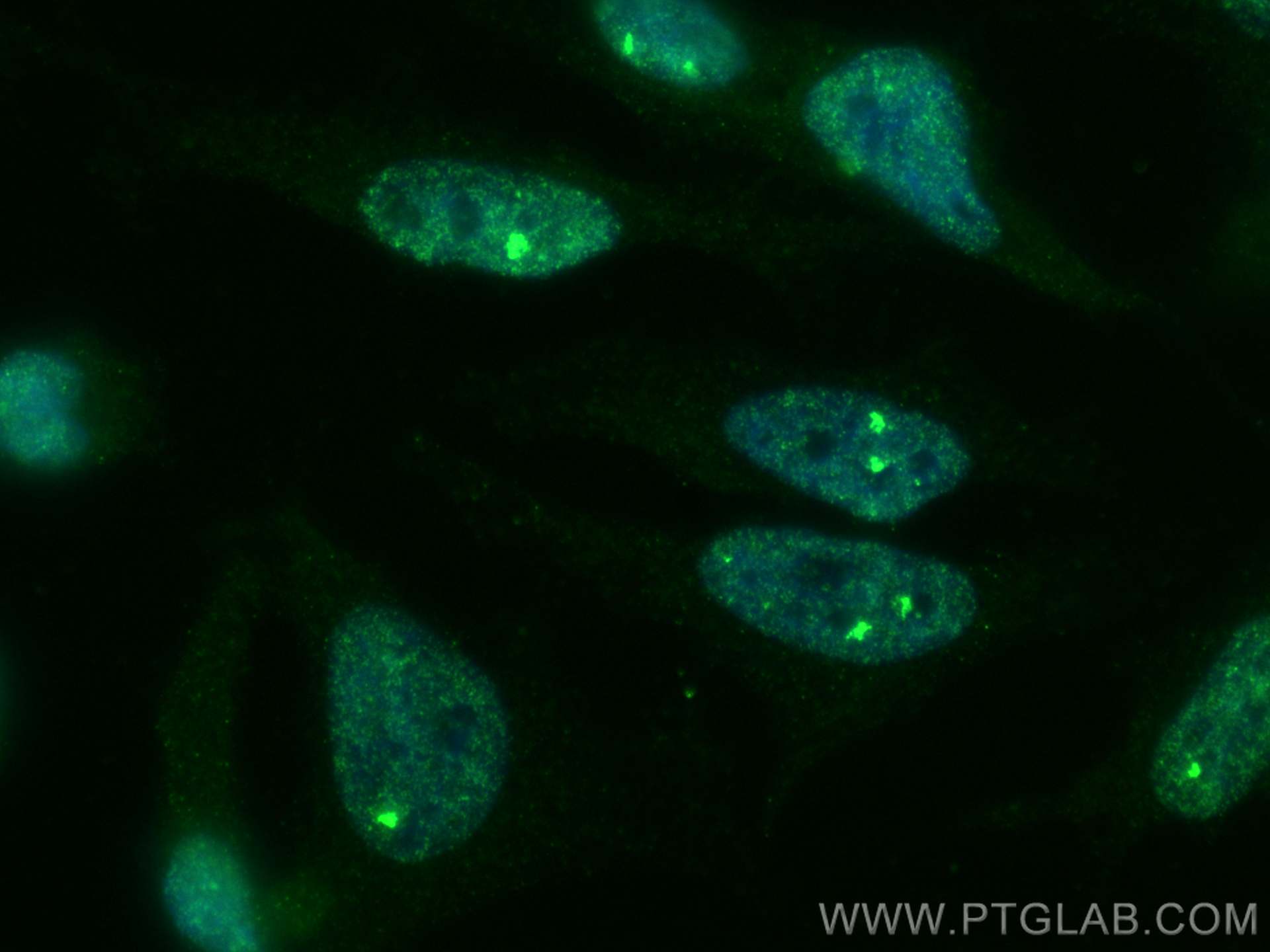 IF Staining of HeLa using 67380-1-Ig