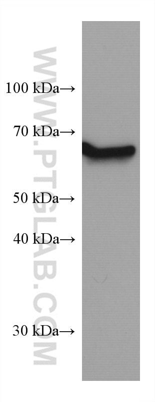 Western Blot (WB) analysis of Jurkat cells using TH1L Monoclonal antibody (67380-1-Ig)