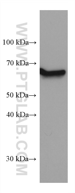 WB analysis of Jurkat using 67380-1-Ig