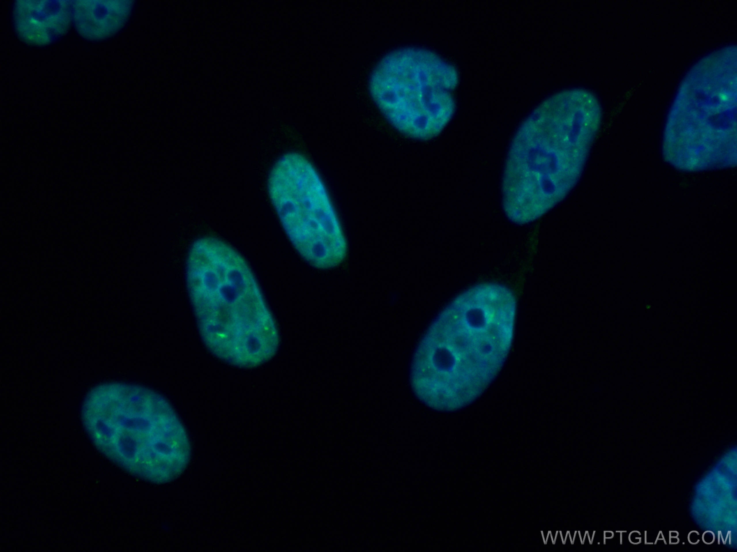 Immunofluorescence (IF) / fluorescent staining of HeLa cells using CoraLite® Plus 488-conjugated TH1L Monoclonal anti (CL488-67380)