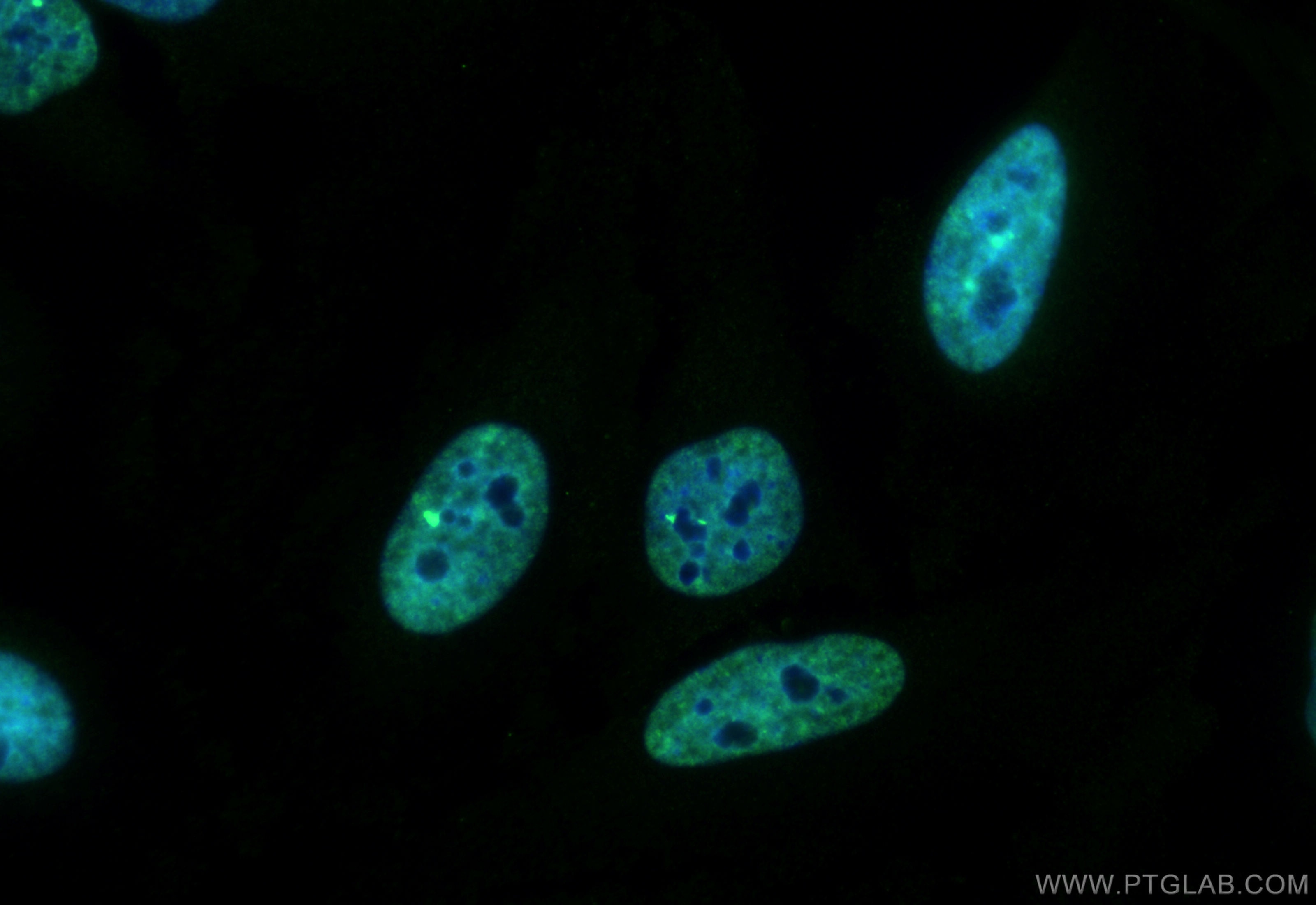Immunofluorescence (IF) / fluorescent staining of HeLa cells using CoraLite® Plus 488-conjugated TH1L Monoclonal anti (CL488-67380)