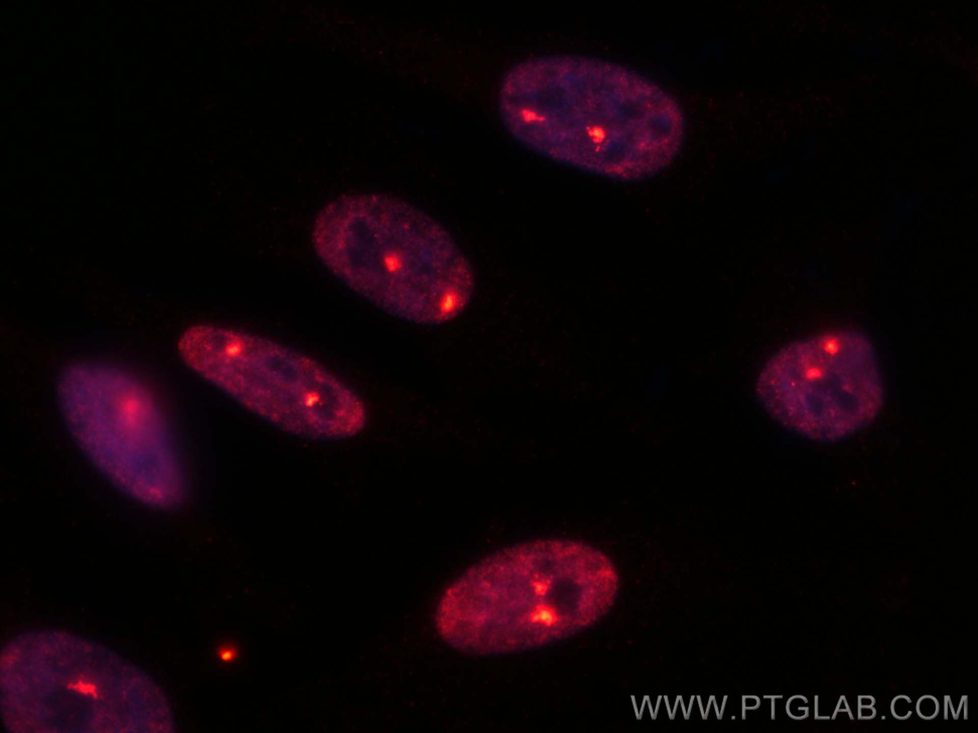 IF Staining of HeLa using CL594-67380