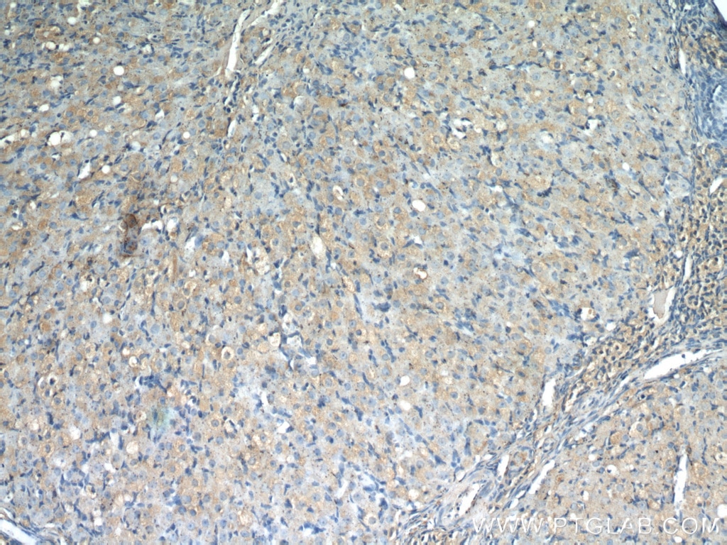 Immunohistochemistry (IHC) staining of rat ovary tissue using THADA Polyclonal antibody (12909-1-AP)