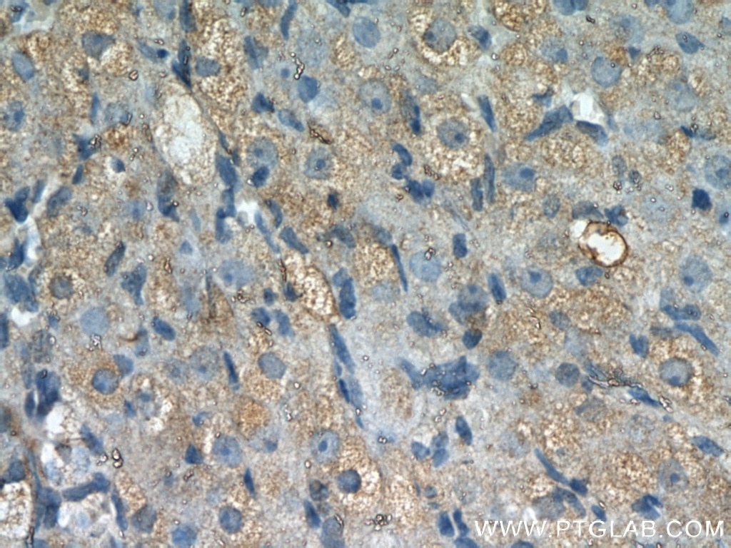 Immunohistochemistry (IHC) staining of rat ovary tissue using THADA Polyclonal antibody (12909-1-AP)