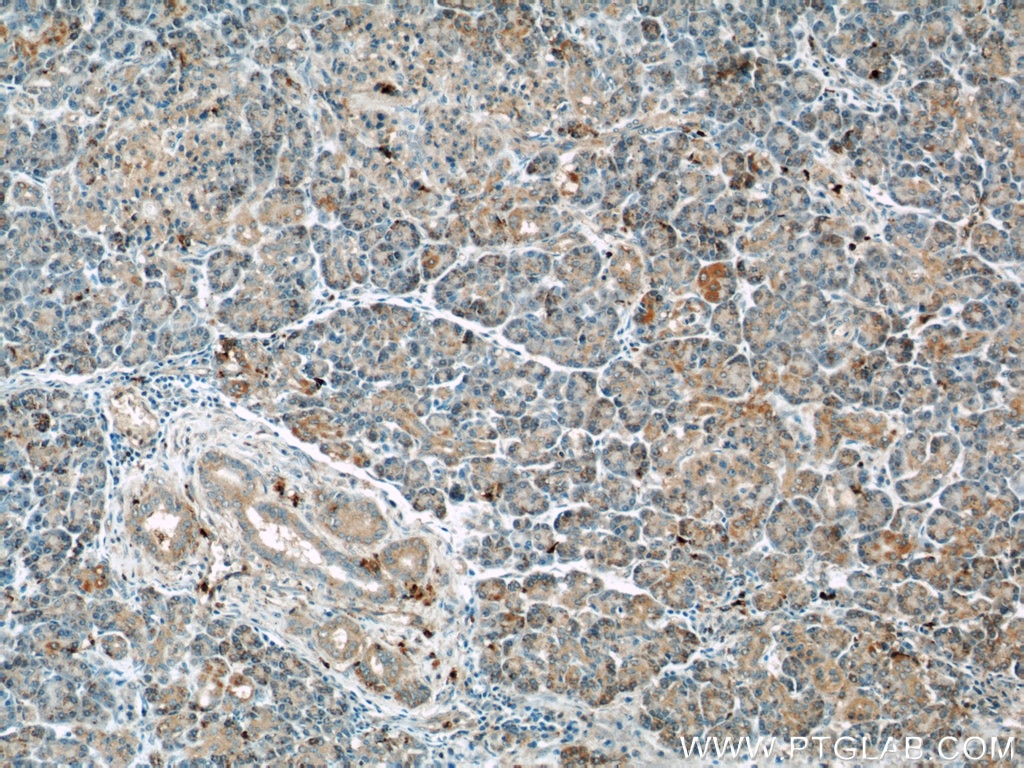 Immunohistochemistry (IHC) staining of human pancreas tissue using THADA Polyclonal antibody (12909-1-AP)