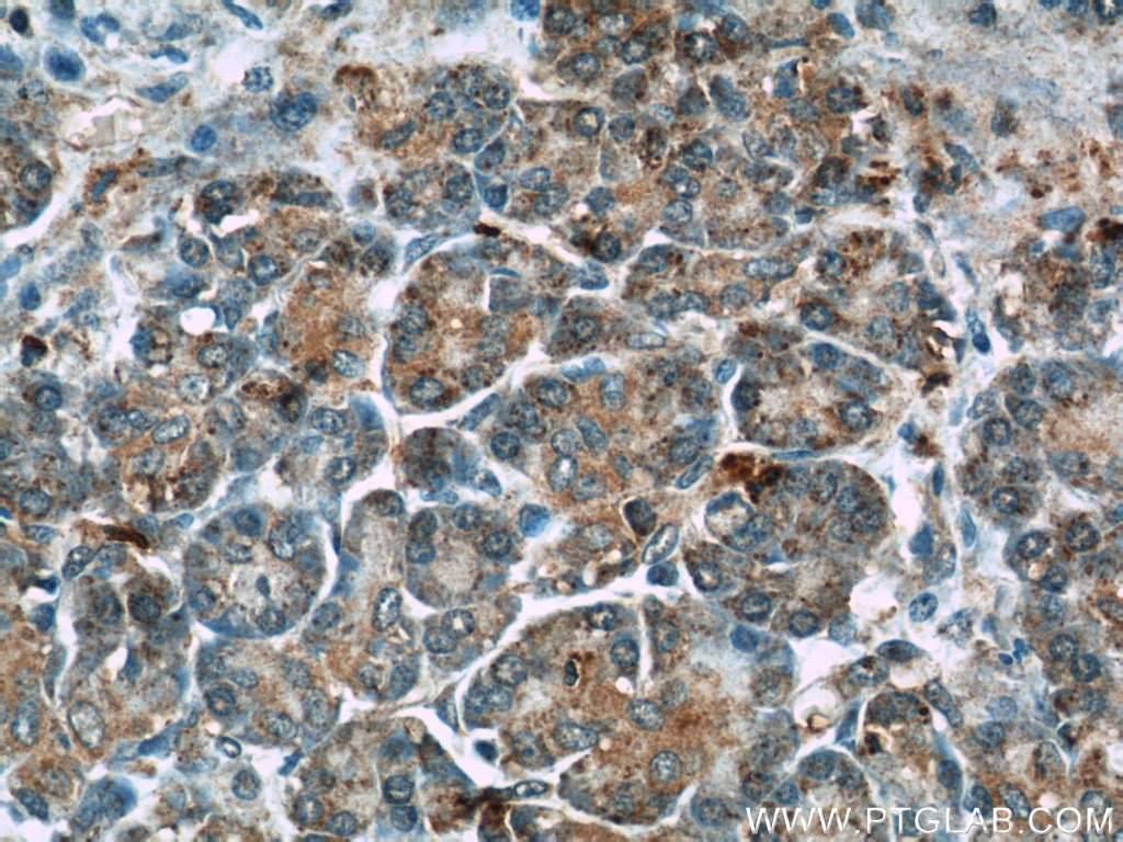 Immunohistochemistry (IHC) staining of human pancreas tissue using THADA Polyclonal antibody (12909-1-AP)