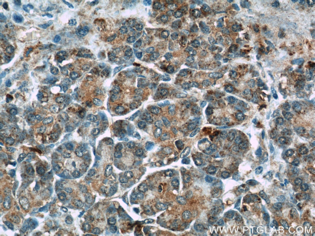 IHC staining of human pancreas using 12909-1-AP