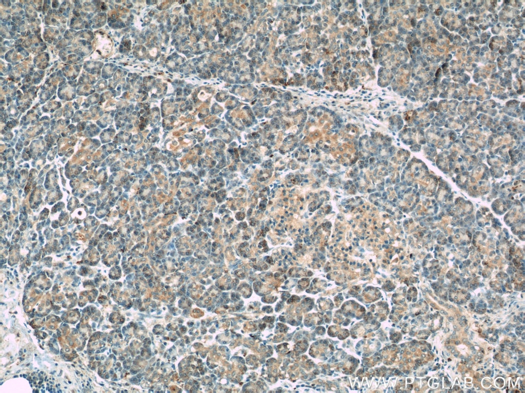 Immunohistochemistry (IHC) staining of human pancreas tissue using THADA Polyclonal antibody (12909-1-AP)