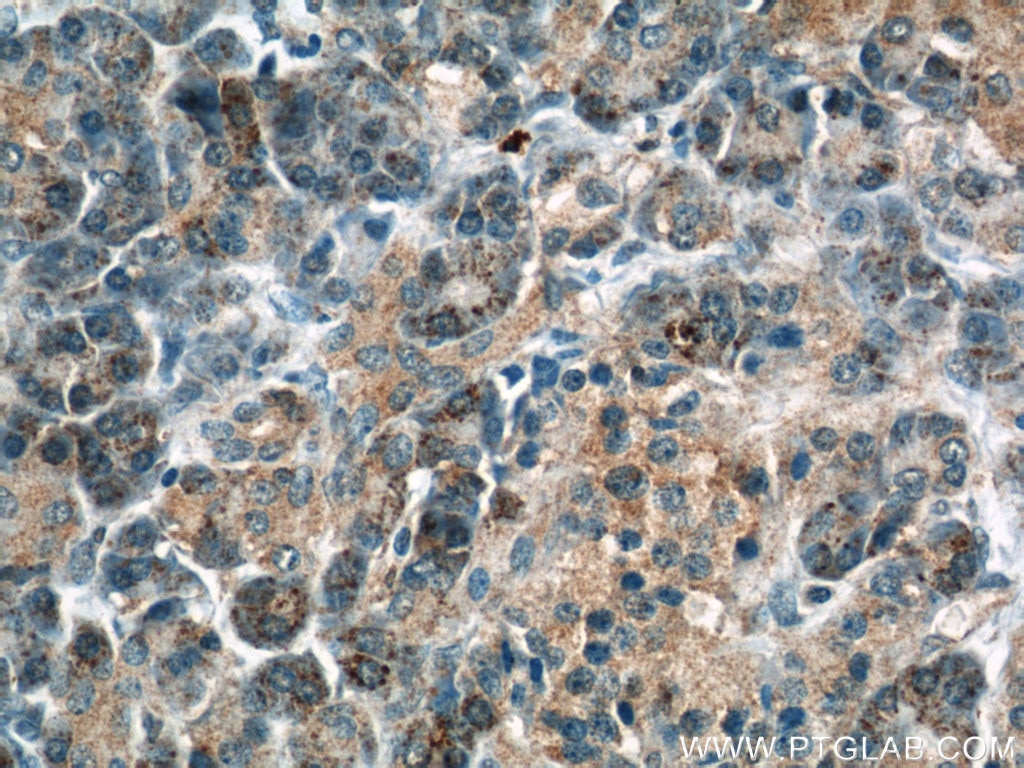 Immunohistochemistry (IHC) staining of human pancreas tissue using THADA Polyclonal antibody (12909-1-AP)