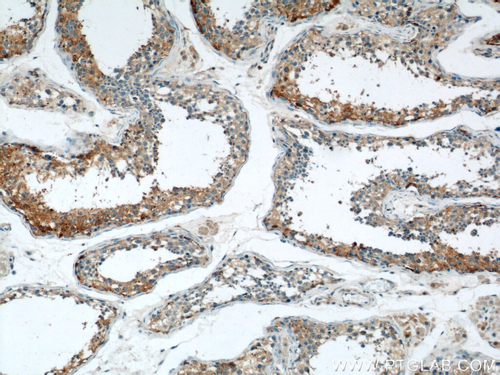 Immunohistochemistry (IHC) staining of human testis tissue using THADA Polyclonal antibody (12909-1-AP)