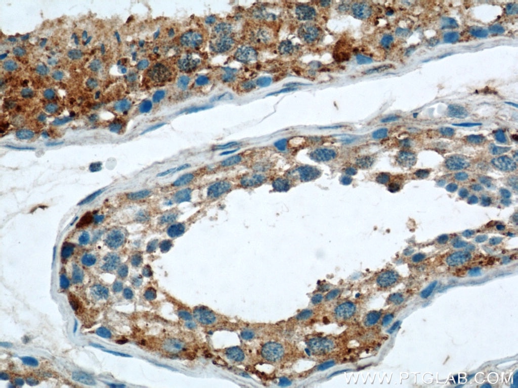 Immunohistochemistry (IHC) staining of human testis tissue using THADA Polyclonal antibody (12909-1-AP)