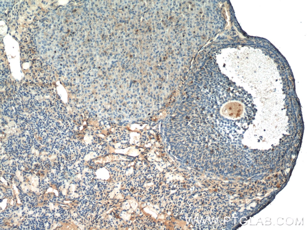 Immunohistochemistry (IHC) staining of mouse ovary tissue using THADA Polyclonal antibody (12909-1-AP)