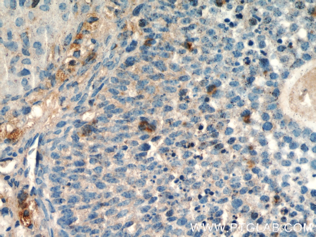 Immunohistochemistry (IHC) staining of mouse ovary tissue using THADA Polyclonal antibody (12909-1-AP)