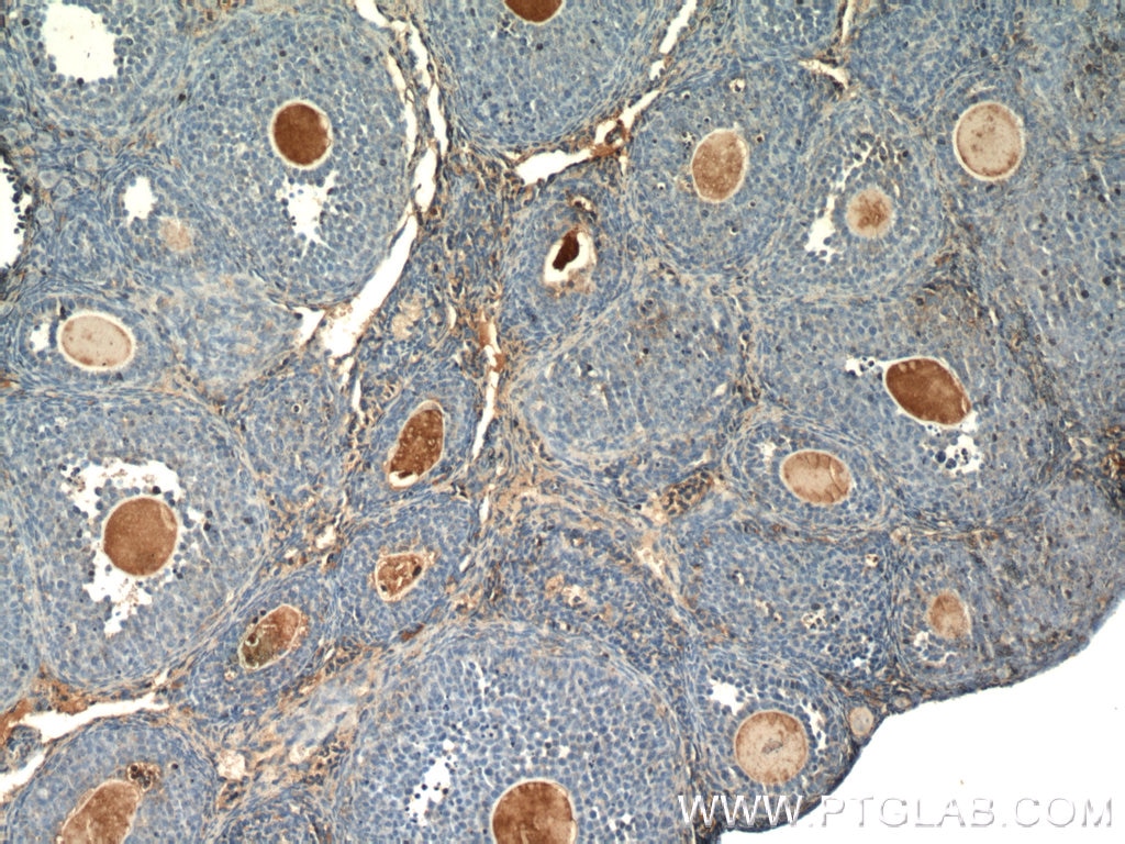 Immunohistochemistry (IHC) staining of mouse ovary tissue using THADA Polyclonal antibody (12909-1-AP)