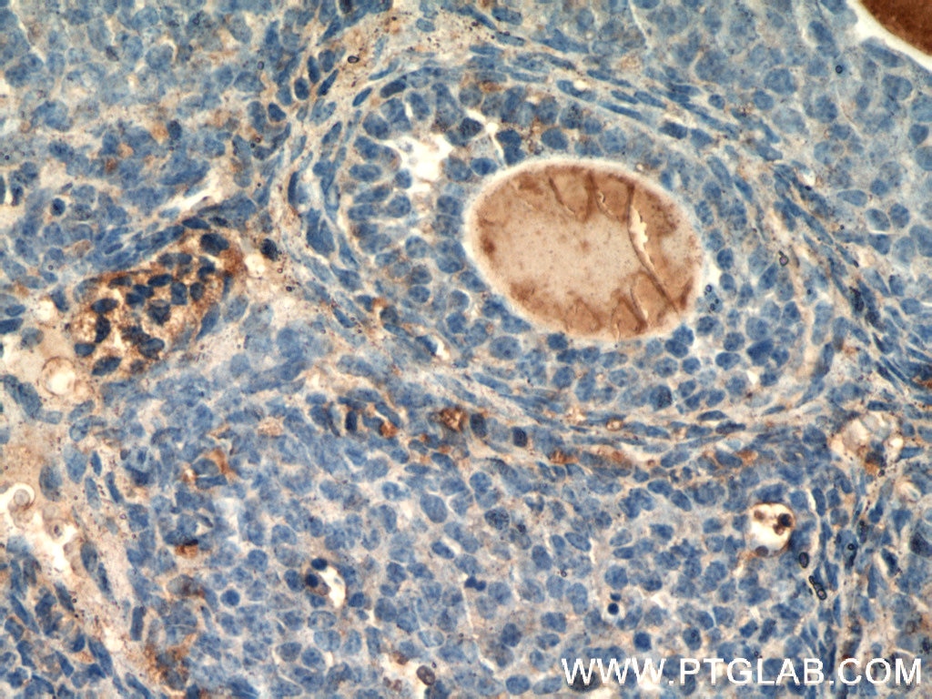 Immunohistochemistry (IHC) staining of mouse ovary tissue using THADA Polyclonal antibody (12909-1-AP)