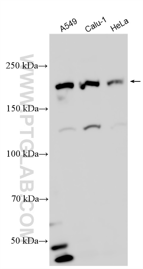 WB analysis using 12909-1-AP Western Blot (WB) analysis of various lysates using THADA Polyclonal antibody (12909-1-AP)