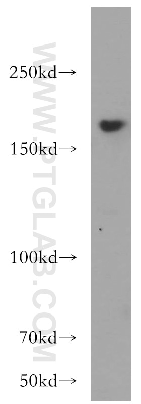 Western Blot (WB) analysis of HeLa cells using THADA Polyclonal antibody (12909-1-AP)