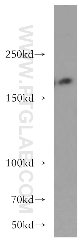 Western Blot (WB) analysis of A549 cells using THADA Polyclonal antibody (12909-1-AP)