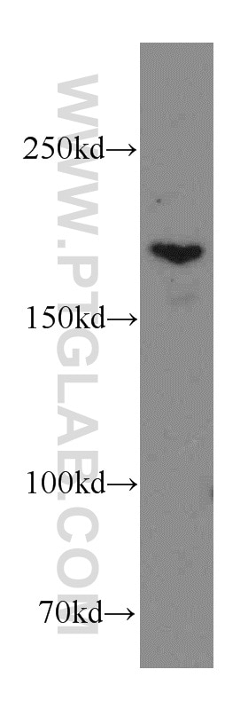 Western Blot (WB) analysis of A549 cells using THADA Polyclonal antibody (12909-1-AP)