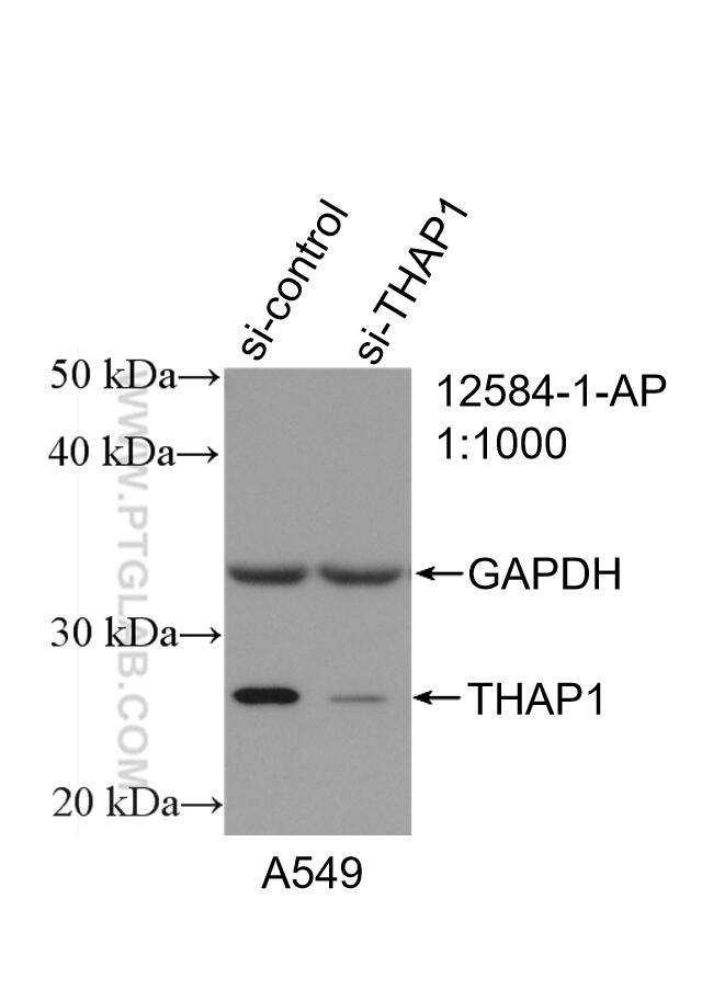 Western Blot (WB) analysis of A549 cells using THAP1 Polyclonal antibody (12584-1-AP)