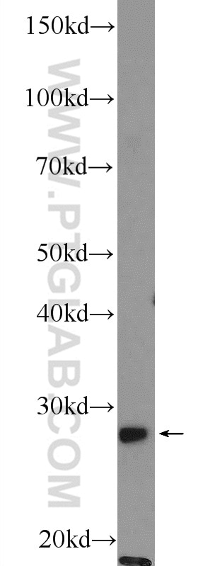 Western Blot (WB) analysis of HeLa cells using THAP1 Polyclonal antibody (12584-1-AP)