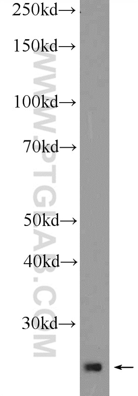 WB analysis of HeLa using 12584-1-AP