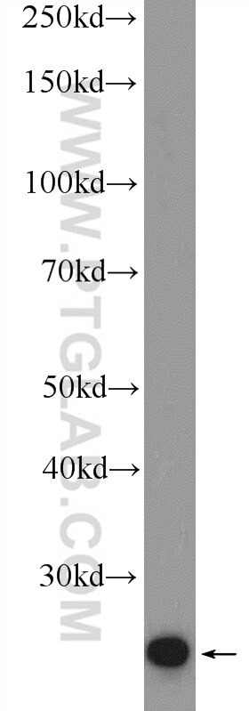 Western Blot (WB) analysis of HEK-293 cells using THAP1 Polyclonal antibody (12584-1-AP)