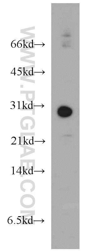 Western Blot (WB) analysis of mouse brain tissue using THAP1 Polyclonal antibody (12584-1-AP)